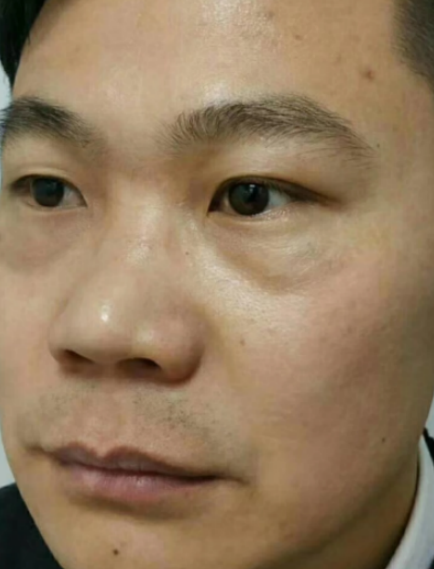 ȥ�۴�����