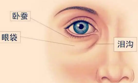 去眼袋手术