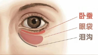 眼袋