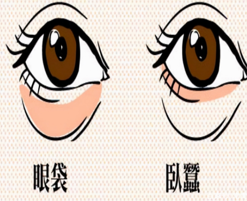 眼袋