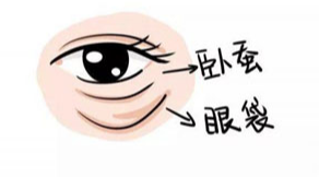 眼袋
