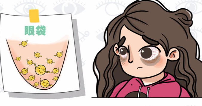 眼袋