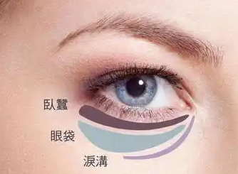 眼袋