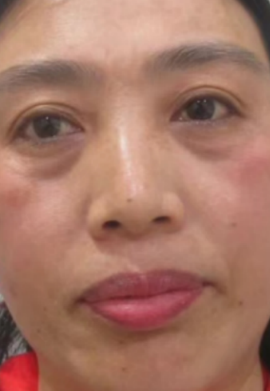 ȥ�۴�����