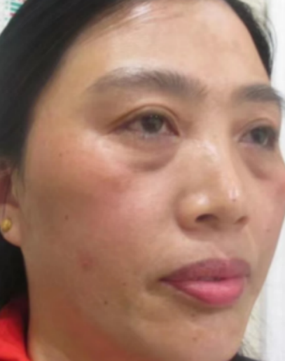 ȥ�۴�����