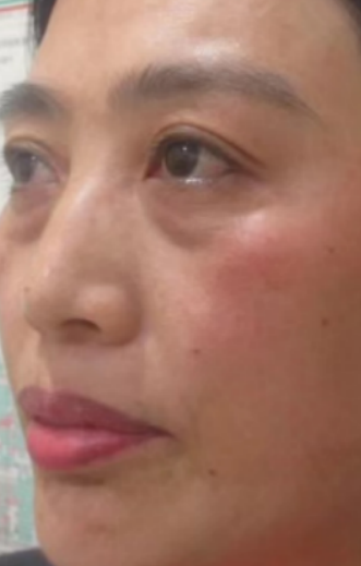 ȥ�۴�����