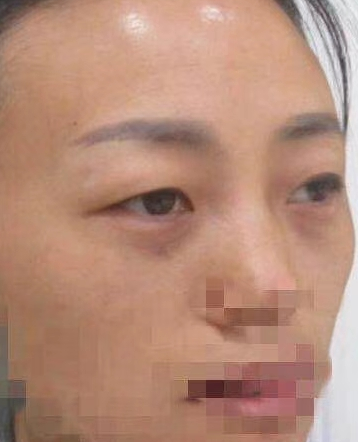 ȥ�۴�����