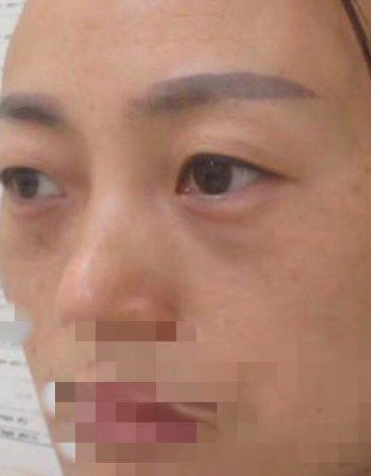 ȥ�۴�����