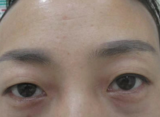 ȥ�۴�����