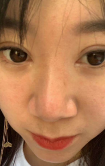 ȥ�۴�����