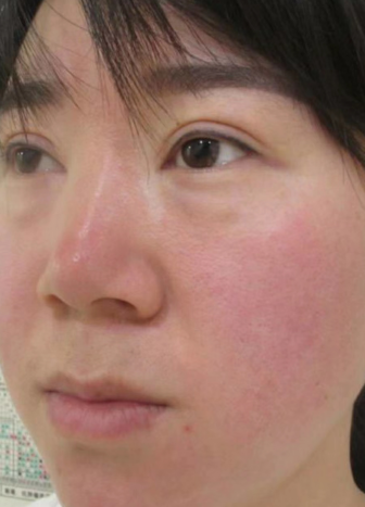 ȥ�۴�����