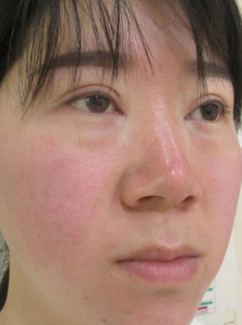 ȥ�۴�����