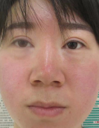 ȥ�۴�����