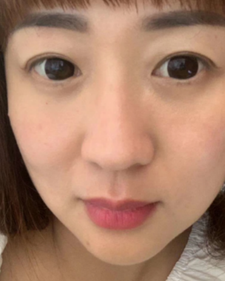 ȥ�۴�����