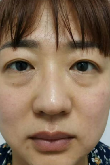 ȥ�۴�����