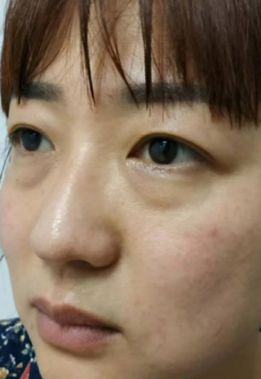 ȥ�۴�����