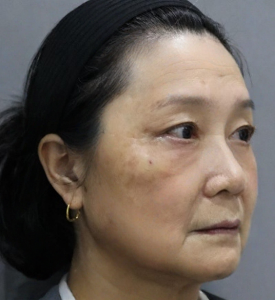 ȥ�۴�����