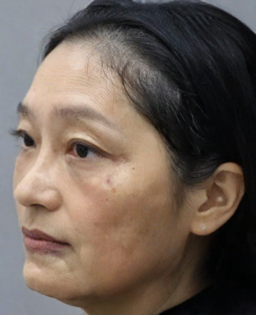 ȥ�۴�����