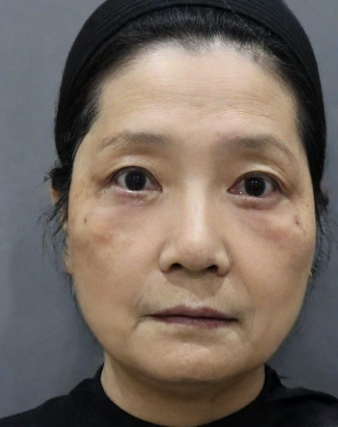 ȥ�۴�����