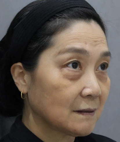 ȥ�۴�����