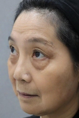 ȥ�۴�����