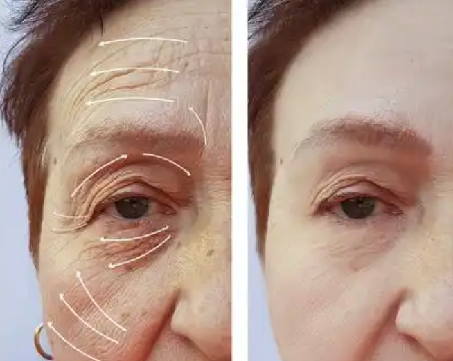 ȥ�۴�����