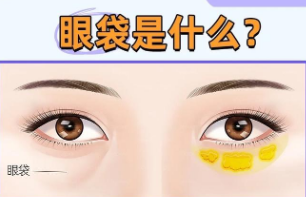 眼袋