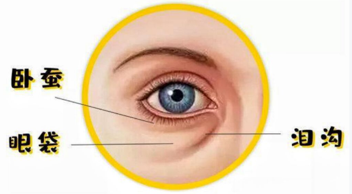 眼袋