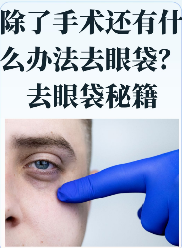 去眼袋手术