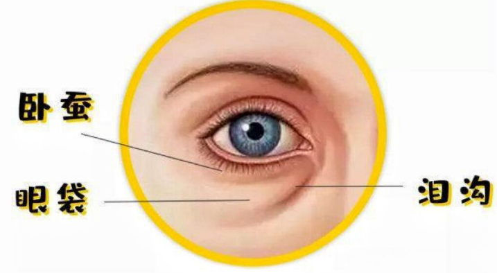 眼袋