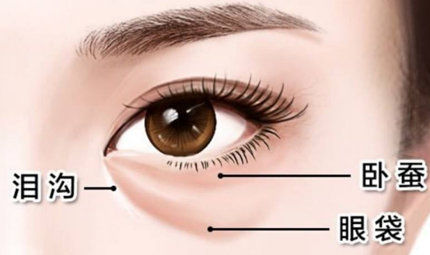 眼袋