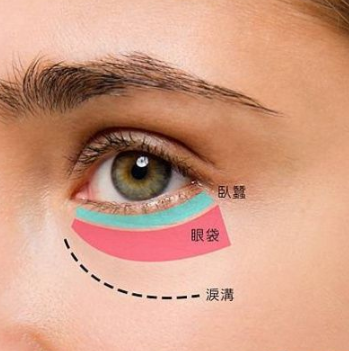 眼袋