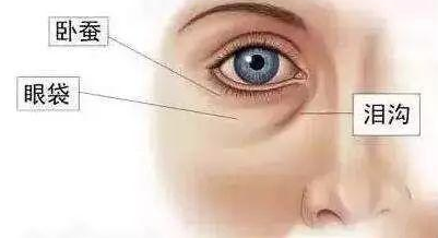 眼袋