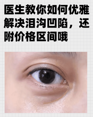 �ṵ