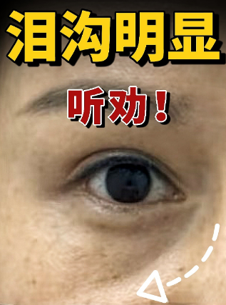 �ṵ