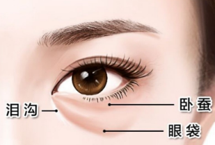 去眼袋手术