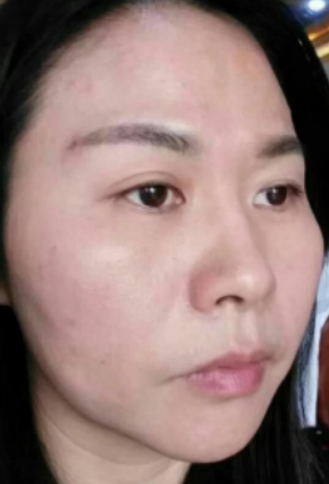眼袋