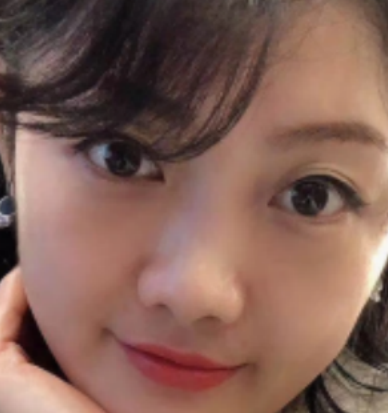 眼袋