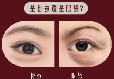 去眼袋手术