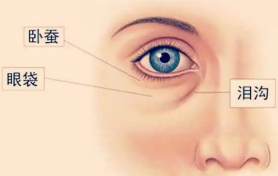 眼袋