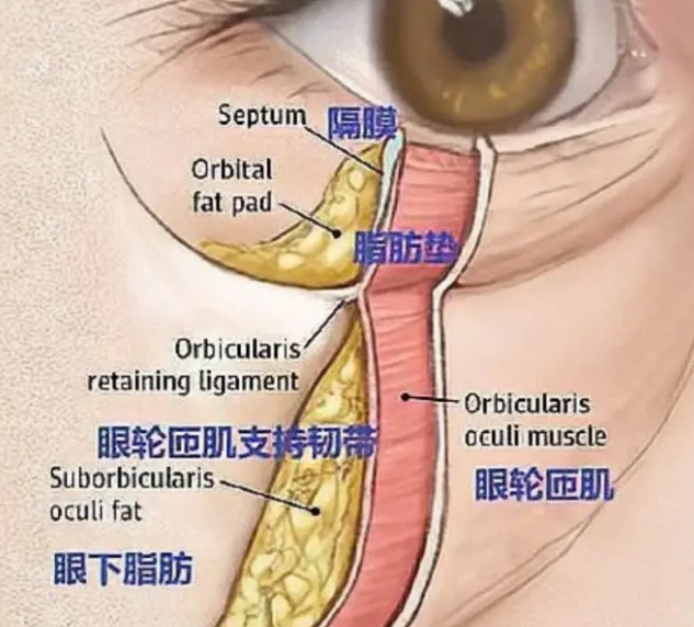 去眼袋手术