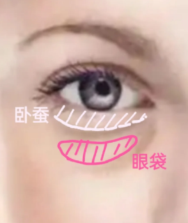 眼袋