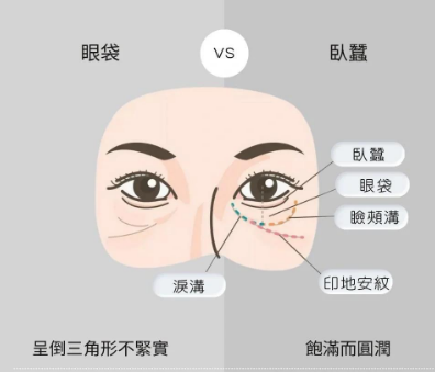 眼袋