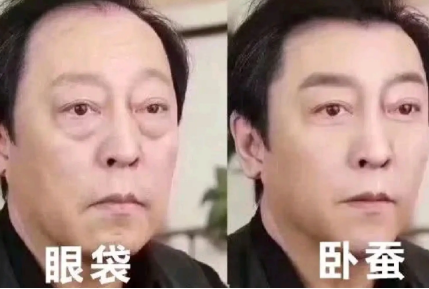 眼袋