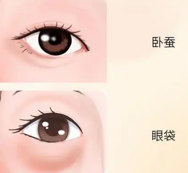 眼袋