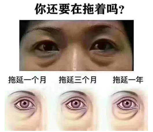 去眼袋手术