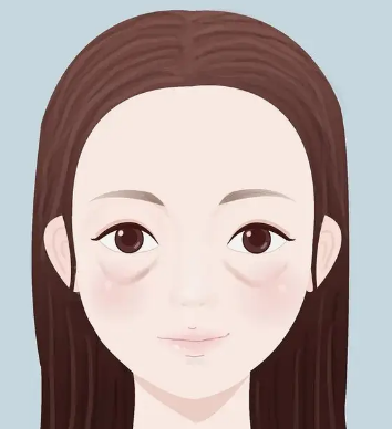 眼袋