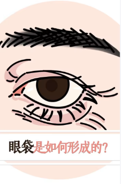 眼袋