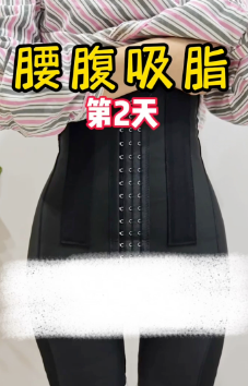 超声波减肥
