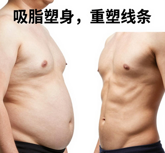 超声波减肥
